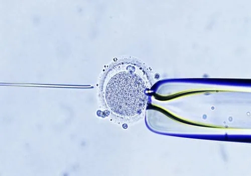 美国试管婴儿技术对女性健康有影响吗？