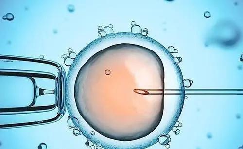 试管婴儿胚胎移植必须要符合哪些条件才能开展？