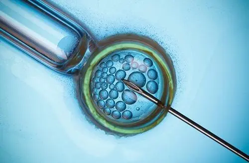 以ICSI单精子注射技术视角来剖析美国试管婴儿优势
