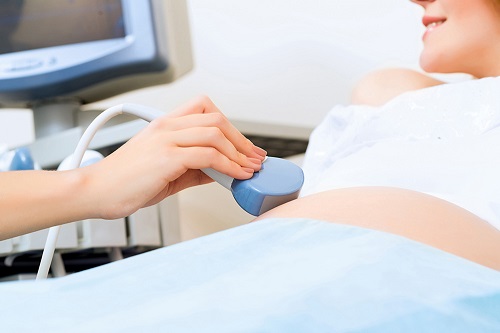 二胎做美国试管婴儿，移植后可以避免疤痕妊娠吗？