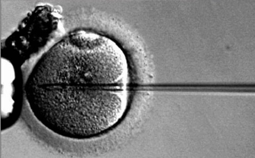 试管婴儿会不会遗传不孕症到下一代？