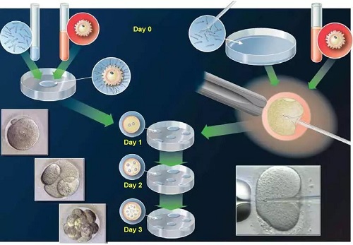试管婴儿成功率高低到底由哪些因素决定？